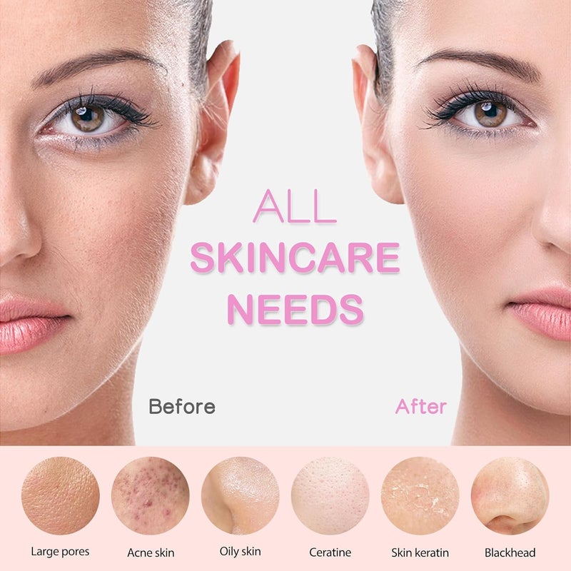 pritech Facial Cleansing Brush, Rechargeable Silicone Face Scrubber with Heat Massage End, Vibrating Exfoliator Scrubber for Deep Cleaning, Waterproof Face Brush for Women and Men (Pink) - Image 5